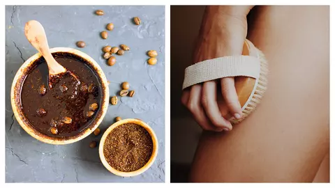 Remedii naturale pentru a reduce celulita