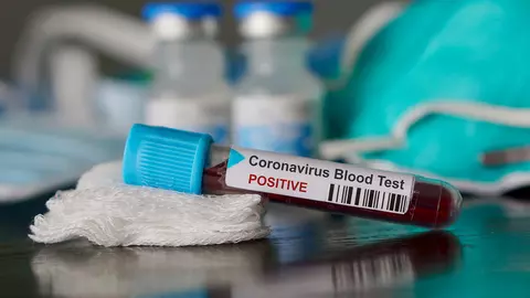Care este județul din România fără niciun deces provocat de coronavirus?