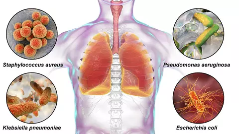 Ce sunt infecțiile nosocomiale și care sunt cele mai des întâlnite microorganisme în spitalele din România
