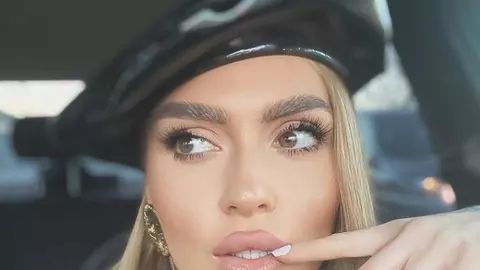 Oana Radu, probleme cu tenul: „Am făcut-o de oaie”