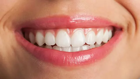 (P) Un implant dentar de calitate îți poate asigura beneficii la care nici nu te gândeai!