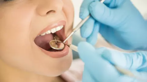 (P) Cât costă un implant dentar?