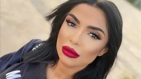 Raluca Drăgoi a slăbit 40 de kilograme într-o manieră extrem de curajoasă. Cum arată acum cântăreața?