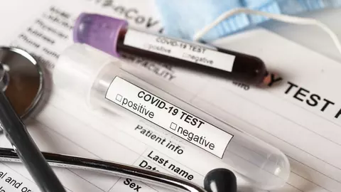 (P) Tipuri de teste Covid19 pe care le poți face pentru a te asigura că poți călători