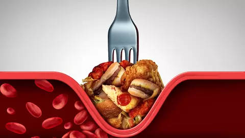 Suferi de hipertensiune arterială? Iată câteva alimente bune pentru această afecțiune