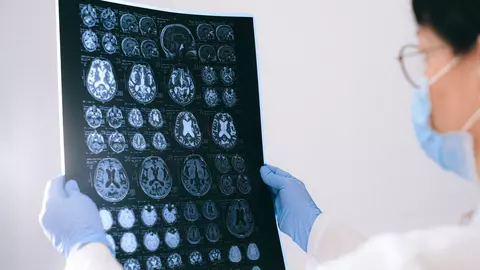 Ce sunt afecțiunile neurochirurgicale și cum le depistăm?