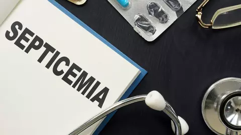 Ce este septicemia, infecția care îi pune viața în pericol marelui actor, Florin Piersic