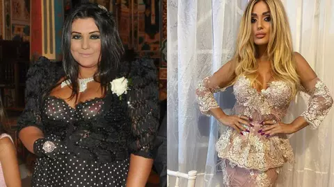 Bianca Rus are probleme de sănătate după ce a slăbit 70 de kilograme: „Mă hrănesc prin perfuzii”