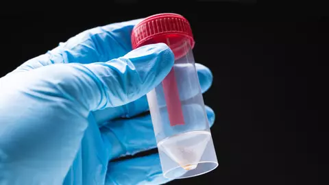 Noul test din salivă care poate prezice dacă veți face forme severe în urma infectării cu Covid-19