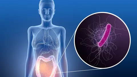 Infecția cu Clostridium Difficile: simptome și risc