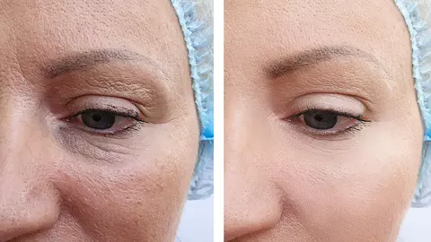 Dr. Dana Bratu:„Biorevitalizarea și rejuvenarea pielii fără ace poartă un singur nume, PRX-T33”