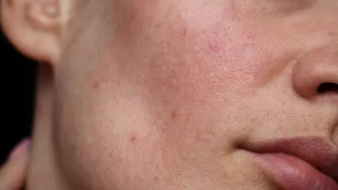 Cum se explică înroșirea feței la emoții puternice sau la efort fizic?