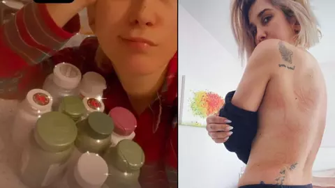 Tratamentul chinuitor pe care îl urmează ADDA pentru a se vindeca: „Iau 26 de pastile pe zi. 18 luni trebuie să fac injecții”