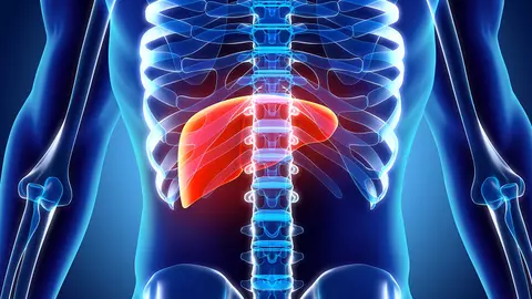 Anumite băuturi preferate de mulți oameni cresc riscul de cancer la ficat cu 78%