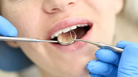 Legătura surprinzătoare între sănătatea orală și sănătatea mentală. Cum își poate da seama medicul dentist că ai o problemă psihologică?