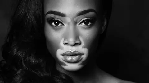 Cum arată acum Winnie Harlow, fotomodelul cu pielea în două culori. Care e boala de care suferă