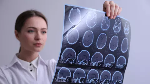 Medicamentul care încetinește boala Alzheimer a fost etichetat ca fiind „istoric”