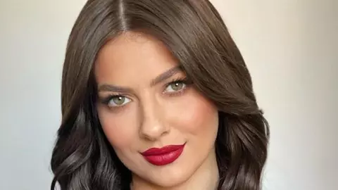 Lidia Buble, afecțiunea de care suferă. Dezvăluirile făcute la „Sunt celebru, scoate-mă de aici!”