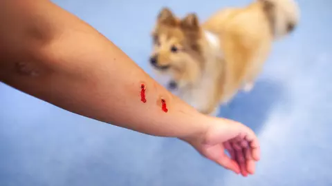 Ai fost mușcat de câine? Iată care sunt pașii pe care trebuie să-i faci