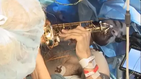 Un bărbat a cântat la saxofon în timpul operației de extirpare a unei tumori cerebrale