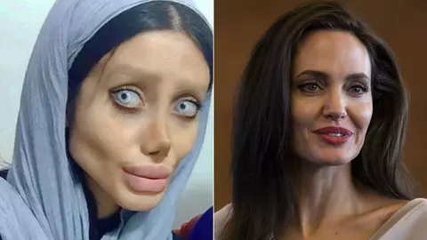 Sahar Tabar, femeia care s-a operat să arate precum Angelina Jolie, și-a arătat adevărata față