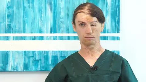 Povestea lui Vasile, care din pacient a devenit ucenic al medicului care i-a schimbat viața: „Îmi doresc să ajung chirurg plastician și să pot să ajut cât mai mulți pacienți”