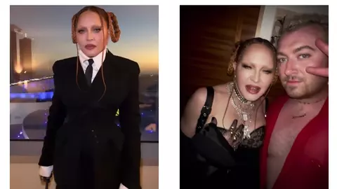 Madonna, reacție în urma criticilor aduse la Grammy 2023: „Inflamația de la operație s-a retras”