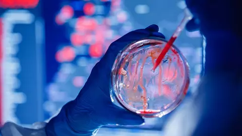 Microbiomul - secretul și cauza multor afecțiuni