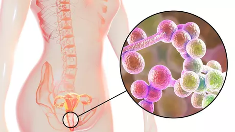 Vaginita bacteriană: cauze și tratament