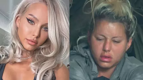 De ce s-a umflat Carmen Grebenișan la față. E de nerecunoscut la Survivor România 2023