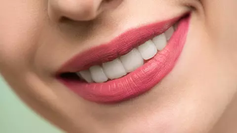 Cum să îți menții dinții sănătoși și frumoși după îndepărtarea aparatului dentar