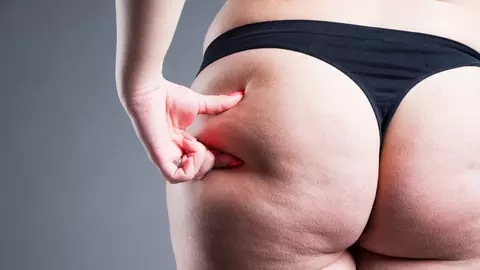 Care este motivul pentru care cremele anti-celulitice cu ardei au rezultate bune?