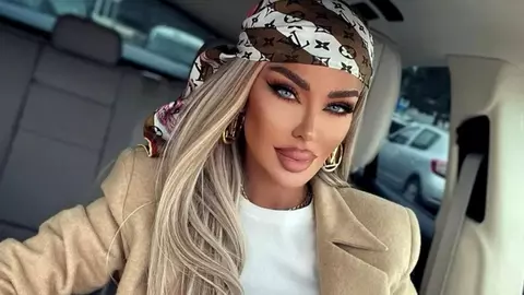 Cum arată Bianca Drăgușanu fără filtre, după și-a făcut lifting facial de 11 mii de euro: „Sunt de porțelan”