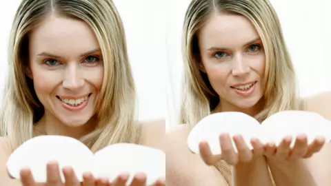 Medicul chirurg estetician explică cum obții sâni cu aspect natural… prin chirurgie estetică: „Cel mai potrivit este să faci două operații în același timp”