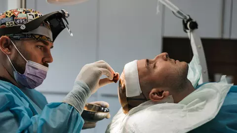 Despre căderea părului și transplantul de păr cu dr. Mihai Motora