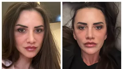 De ce Marei Bănică îi e frică să zâmbească după operația la față: „Au trecut două luni, dar am rămas cu o team”