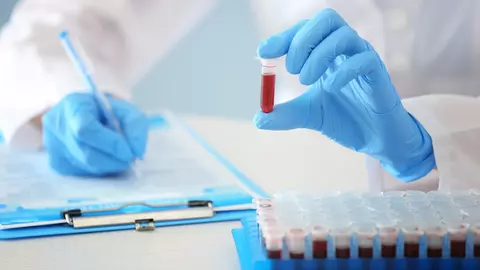 Tratamentul cancerului cu celule stem mezenchimale