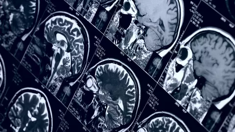 Oamenii de știință avertizează că trei alimente banale ar putea conține paraziți care pot ajunge ușor în creier provocând infecții parazitare