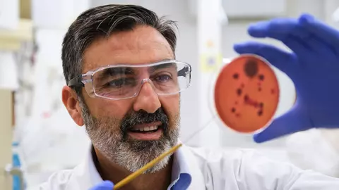 Ce este infecția cu Salmonella (salmoneloza)