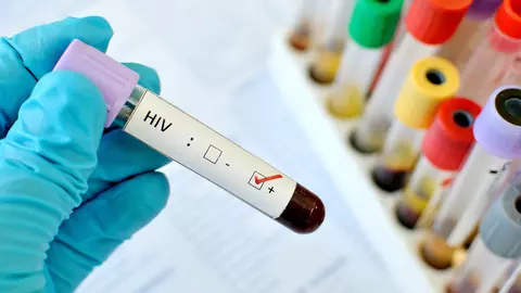 Un bărbat din Germania este a șaptea persoană vindecată complet de HIV