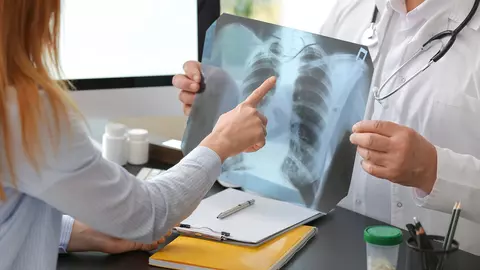 Cum contracarezi efectele unei radiografii?