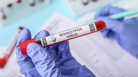 Mpox nu este noul Covid, deoarece autoritățile pot controla răspândirea, subliniază OMS