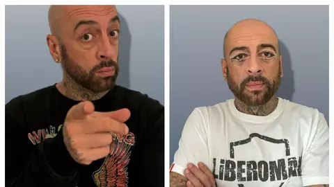 Reacții după ce artistul CRBL și-a făcut prima operație estetică la față: „În locul tău mi-aș face și un baby botox în frunte”. Cum arată acum
