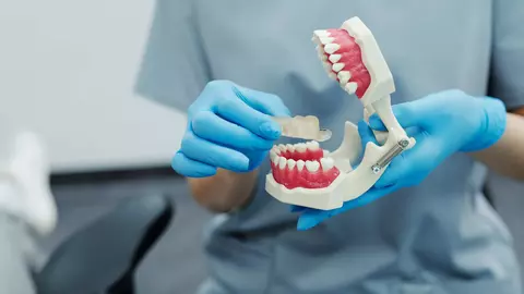 Cum știi că ai nevoie de o proteză dentară