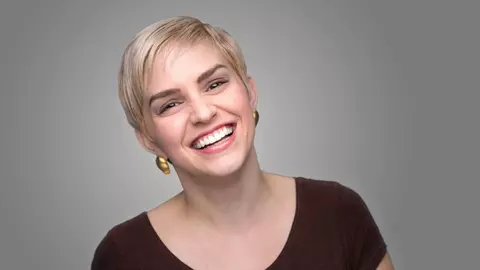 Cum influențeaza fațetele dentare viața de zi cu zi