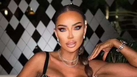 Cât costă noua operație pe care și-a făcut-o Bianca Drăgușanu la față. Procedura chirurgicală nu durează mai mult de 30 de minute