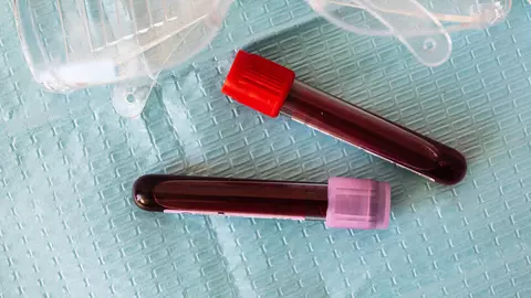 Cum te ajută Synevo să înțelegi mai bine valorile tale medicale