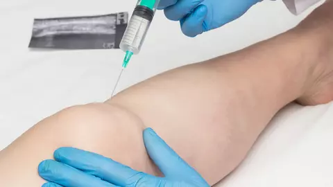Trei motive pentru care ozonoterapia te ajută să-ți consolidezi starea de sănătate înainte de sezonul rece
