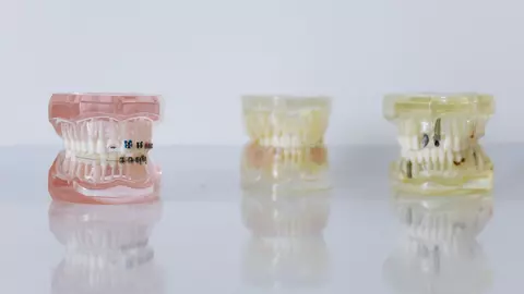 La Dentalist, fiecare pacient primește mai mult decât un tratament – primește atenție reală