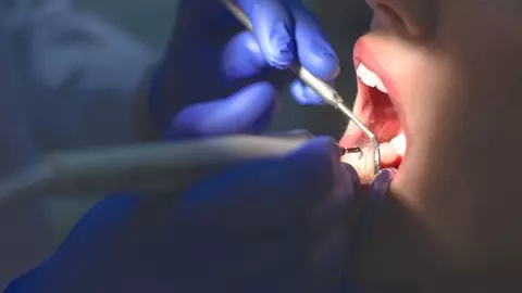 Analiza Costurilor: Cum să Evaluezi Corect Investiția în Tratamentul Estetic Dentar